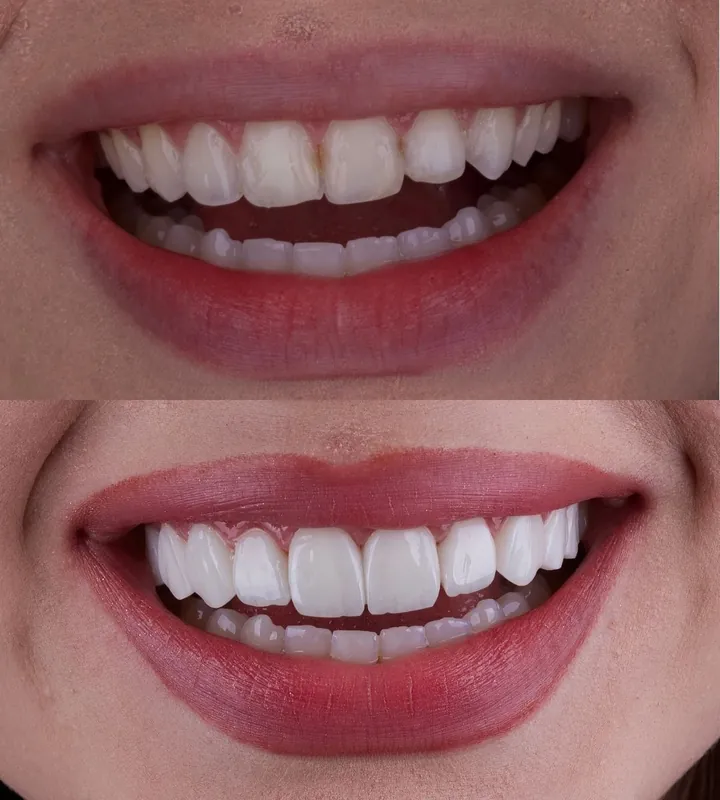 Antes e depois — caso 8