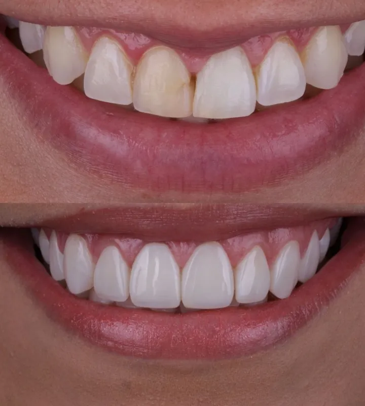 Antes e depois — caso 12